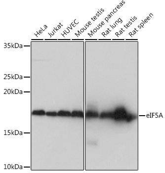 eIF5A Monoclonal Antibody [3R10I7]