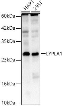 LYPLA1 Polyclonal Antibody