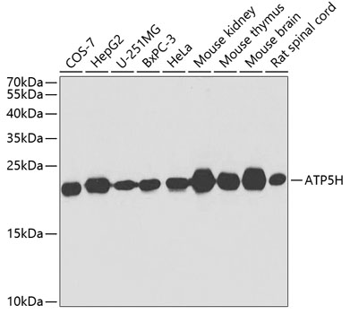 ATP5H Polyclonal Antibody