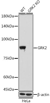GRK2 Monoclonal Antibody [1E5K3]
