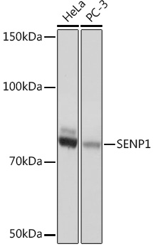 SENP1 Monoclonal Antibody [1C3I4]