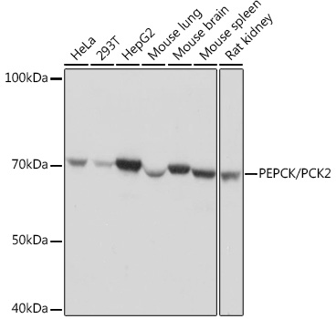PEPCK/PCK2 Monoclonal Antibody [10L10J8]