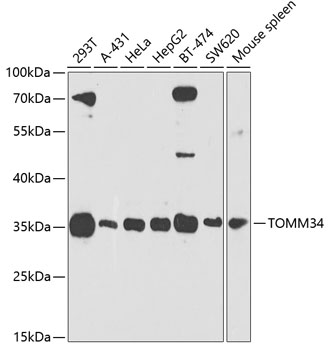 TOMM34 Polyclonal Antibody