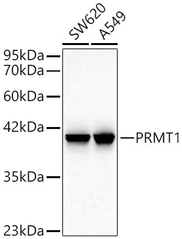 PRMT1 Monoclonal Antibody [10W10U4]