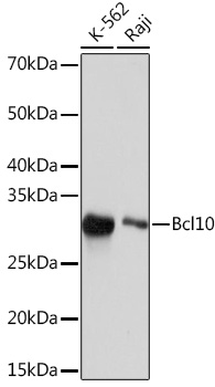 Bcl10 Monoclonal Antibody [8H7A5]