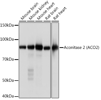 Aconitase 2 (ACO2) Monoclonal Antibody [0P3H3]&nbsp;<img src="images/icon_newarrival.gif" alt="new" border="0">