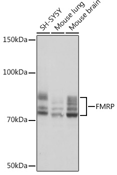 FMRP Monoclonal Antibody [4Y8I5]