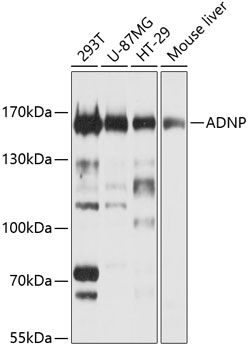 ADNP Polyclonal Antibody&nbsp;<img src="images/icon_newarrival.gif" alt="new" border="0">