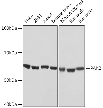 PAK2 Monoclonal Antibody [2Y7I2]