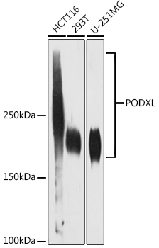PODXL Monoclonal Antibody [6S9A9]