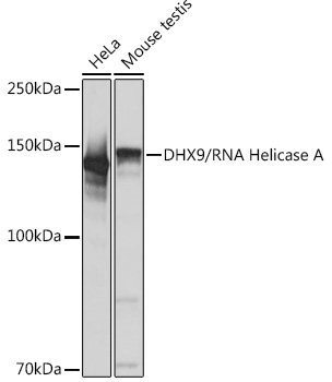 DHX9/RNA Helicase A Monoclonal Antibody [2I6C5]