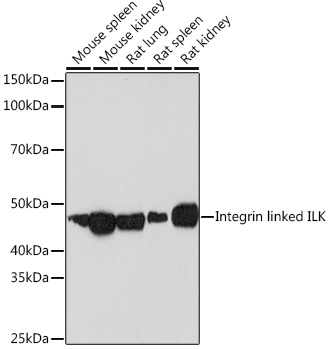 Integrin linked ILK Monoclonal Antibody [5R10U3]