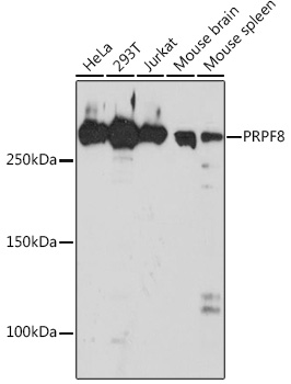 PRPF8 Monoclonal Antibody [4I1Q8]
