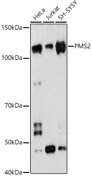 PMS2 Monoclonal Antibody [4E5F1]