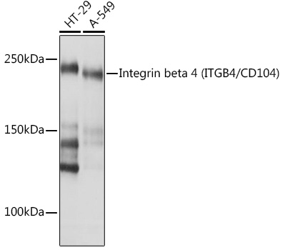 Integrin beta 4 (ITGB4/CD104) Monoclonal Antibody [5Z9P3]