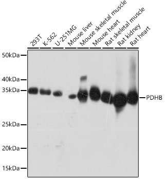 PDHB Monoclonal Antibody [7V8O5]