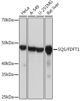 SQS/FDFT1 Monoclonal Antibody [4W10J4]