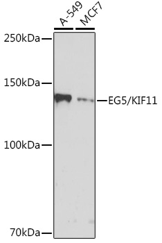 EG5/KIF11 Monoclonal Antibody [6G8V8]