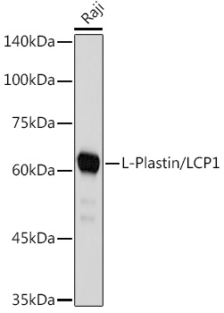 L-Plastin/LCP1 Monoclonal Antibody [3T0M1]