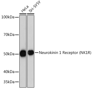 Neurokinin 1 Receptor (NK1R) Monoclonal Antibody [9T1W2]