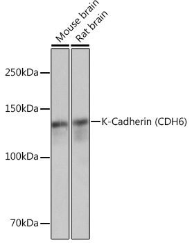 K-Cadherin (CDH6) Monoclonal Antibody [5N2K3]