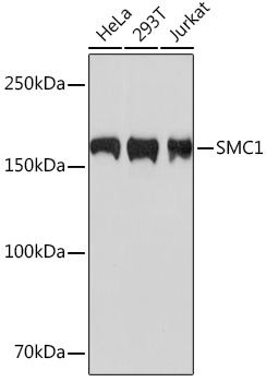 SMC1 Monoclonal Antibody [3M5E3]