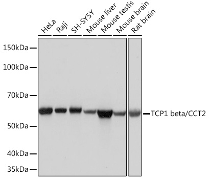 TCP1 beta/CCT2 Monoclonal Antibody [9N6B4]