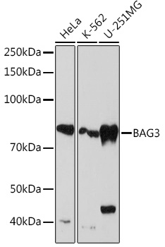 BAG3 Monoclonal Antibody [8P3W7]