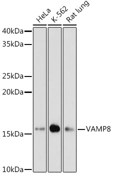 VAMP8 Monoclonal Antibody [5H9S4]
