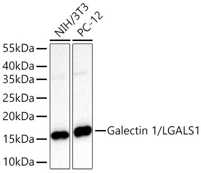 Galectin 1/LGALS1 Monoclonal Antibody [7W5Q6]
