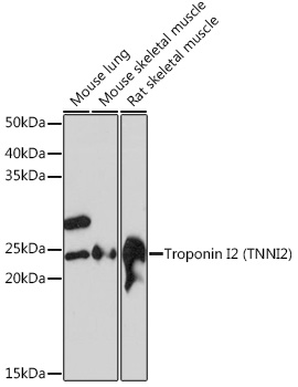 Troponin I2 (TNNI2) Monoclonal Antibody [2H7S10]