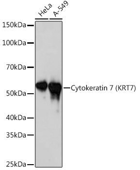 Cytokeratin 7 (KRT7) Monoclonal Antibody [6Q1B4]