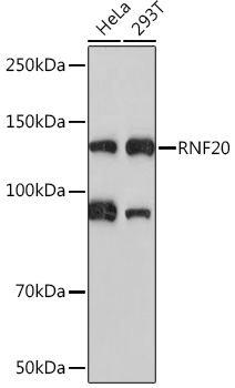 RNF20 Monoclonal Antibody [8N4O8]