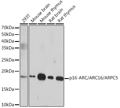 p16-ARC/ARC16/ARPC5 Monoclonal Antibody [7W9M7]
