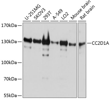 CC2D1A Polyclonal Antibody