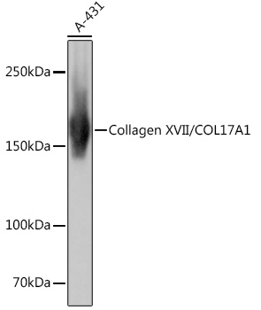 Collagen XVII/COL17A1 Monoclonal Antibody [8W2C8]