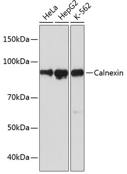 Calnexin Monoclonal Antibody [5S3U3]