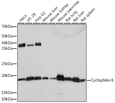 Cyclophilin B Monoclonal Antibody [7Z4S7]