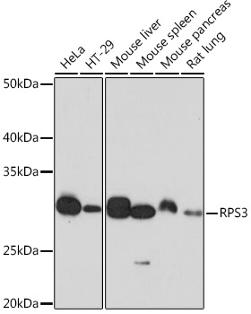 RPS3 Monoclonal Antibody [3X2M4]
