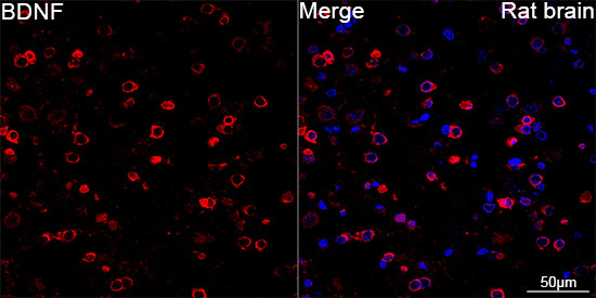 BDNF Monoclonal Antibody [2B0U9]