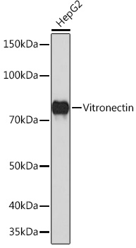 Vitronectin Monoclonal Antibody [2V2V8]