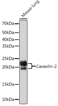 Caveolin-2 Monoclonal Antibody [8I4U7]