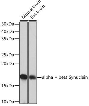 alpha + beta Synuclein Monoclonal Antibody [9E9X5]