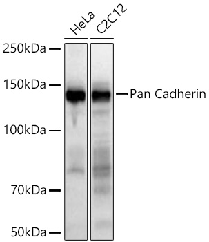 Pan Cadherin Monoclonal Antibody [6N5P8]