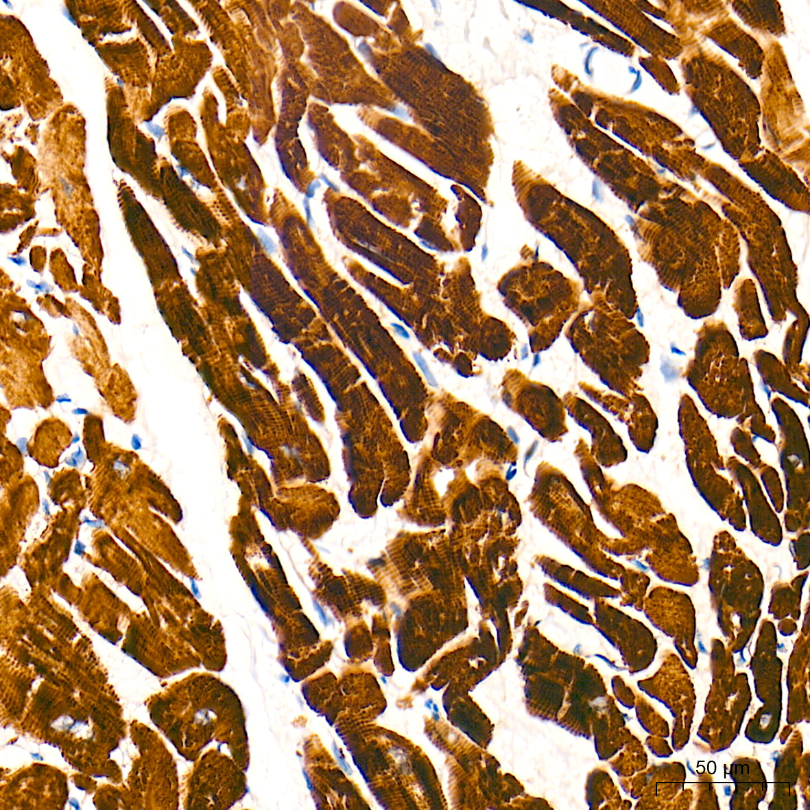 Cardiac troponin T (TNNT2) Monoclonal Antibody [10H9D8]