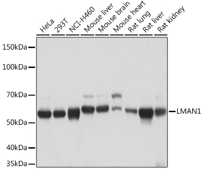 LMAN1 Monoclonal Antibody [3A1X6]
