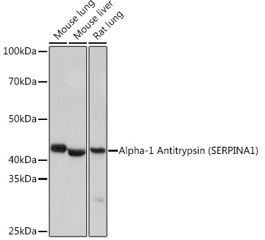 Alpha-1 Antitrypsin (SERPINA1) Monoclonal Antibody [1J3E7]