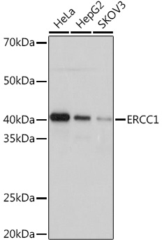 ERCC1 Monoclonal Antibody [5F9U0]