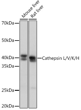 Cathepsin L/V/K/H Monoclonal Antibody [2Q10F10]