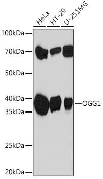 OGG1 Monoclonal Antibody [8V2Q9]